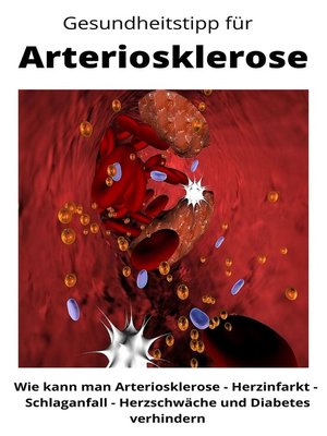 cover image of Gesundheitstipp für Arteriosklerose